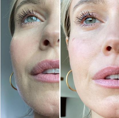 DermaFlow 3-Step Dermaplaning Kit w/ Hair Reveal Spray™